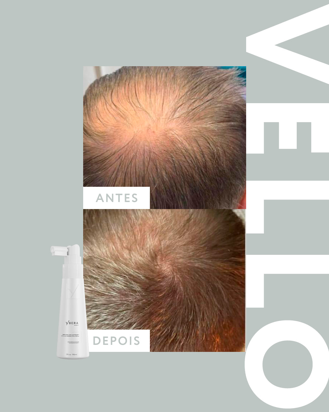 Vello ALFA-ACTOBABY® - Vital Serum 90ml