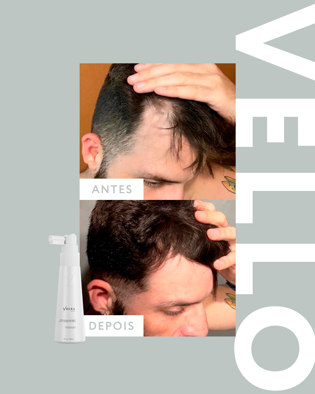 Vello ALFA-ACTOBABY® - Vital Serum 90ml